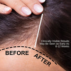 Ammuri Natural Hair Oil – Nourishing Scalp & Hair Care for Thicker-Looking Hair (50ml)